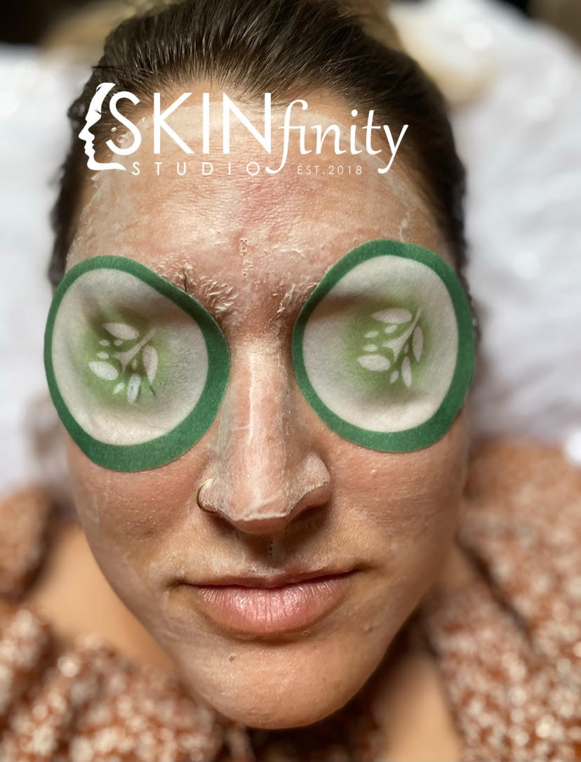 SKINfinity Facial $100