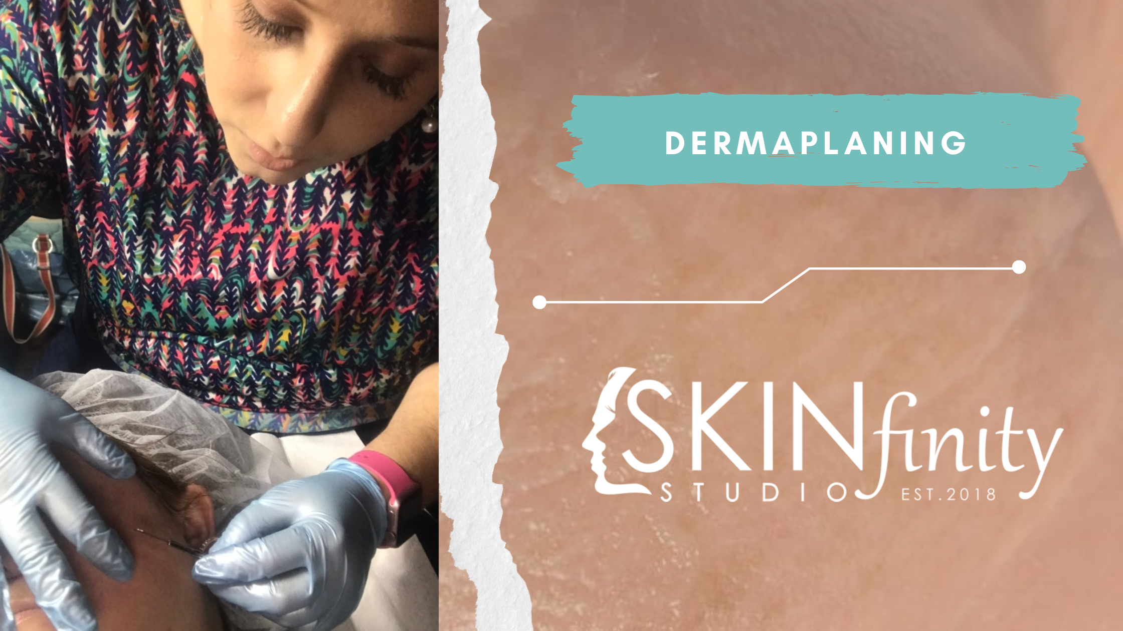 Dermaplaning Facial Treatment $100